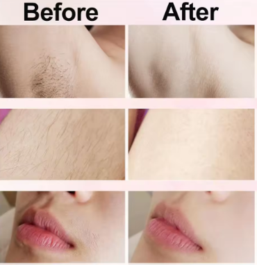 Body and Facial Hair Trimmer